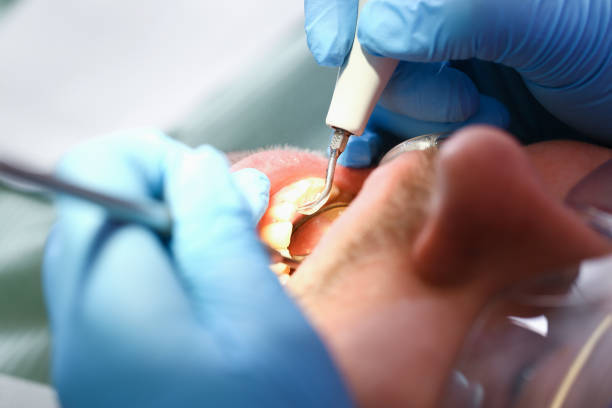 Best Walk-In Emergency Dentist in Ben Wheeler, TX