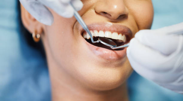 Best Emergency Broken Tooth Repair in Ben Wheeler, TX