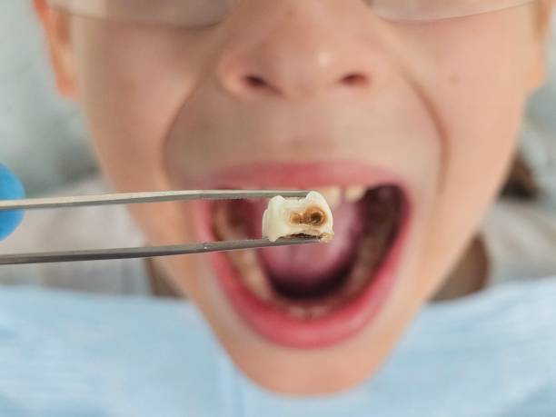 Best After-Hours Emergency Dentist in Ben Wheeler, TX